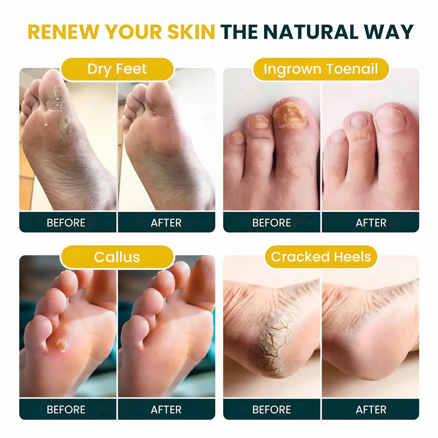 Citrus Detox Foot Soak with Epsom Salts – for Foot Callus, Da​​​​maged Toenail Appearance, Pedicure Spa, and Soothing Sore, Tired Feet – Made in USA – 16oz